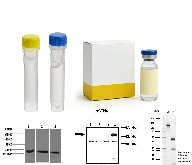  p53 Mouse Monoclonal Antibody